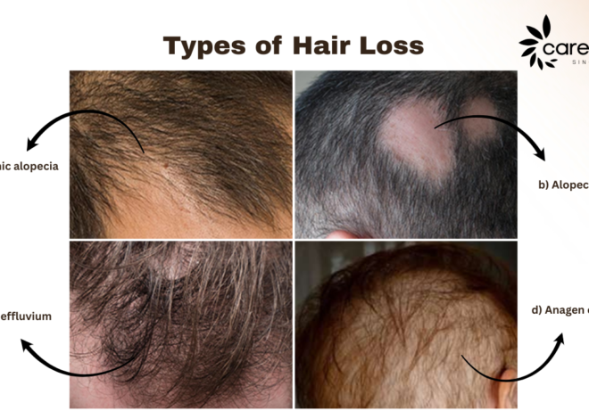 Hair Loss: 5-Causes, Symptoms, Treatment, and Prevention